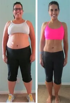 Antes e depois de cliente usando Violine Shape