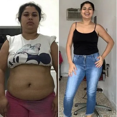 Antes e depois de cliente usando Violine Shape
